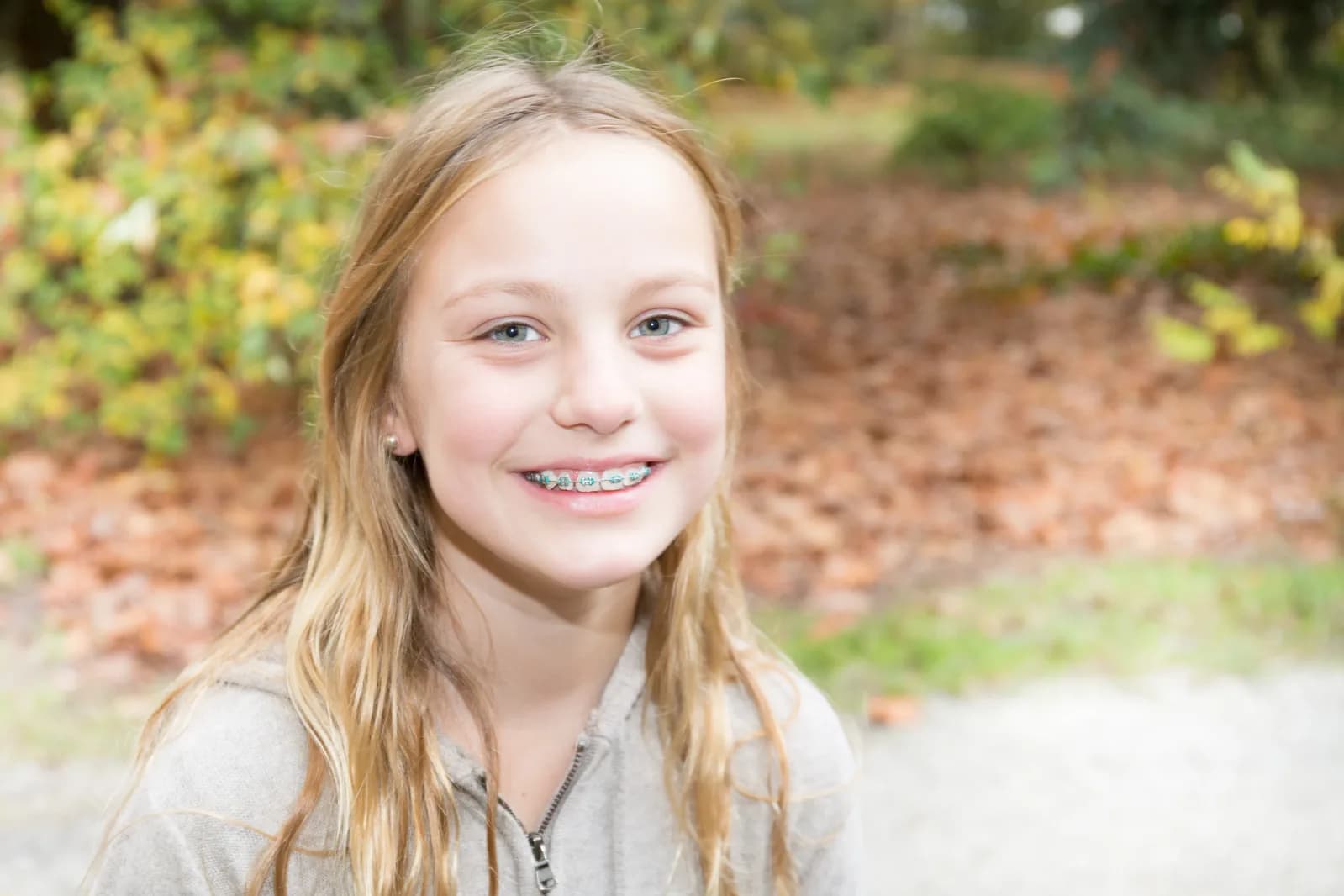 Traditional braces in St. Albert