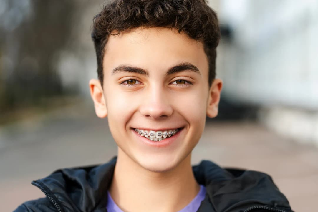 Orthodontic braces treatment