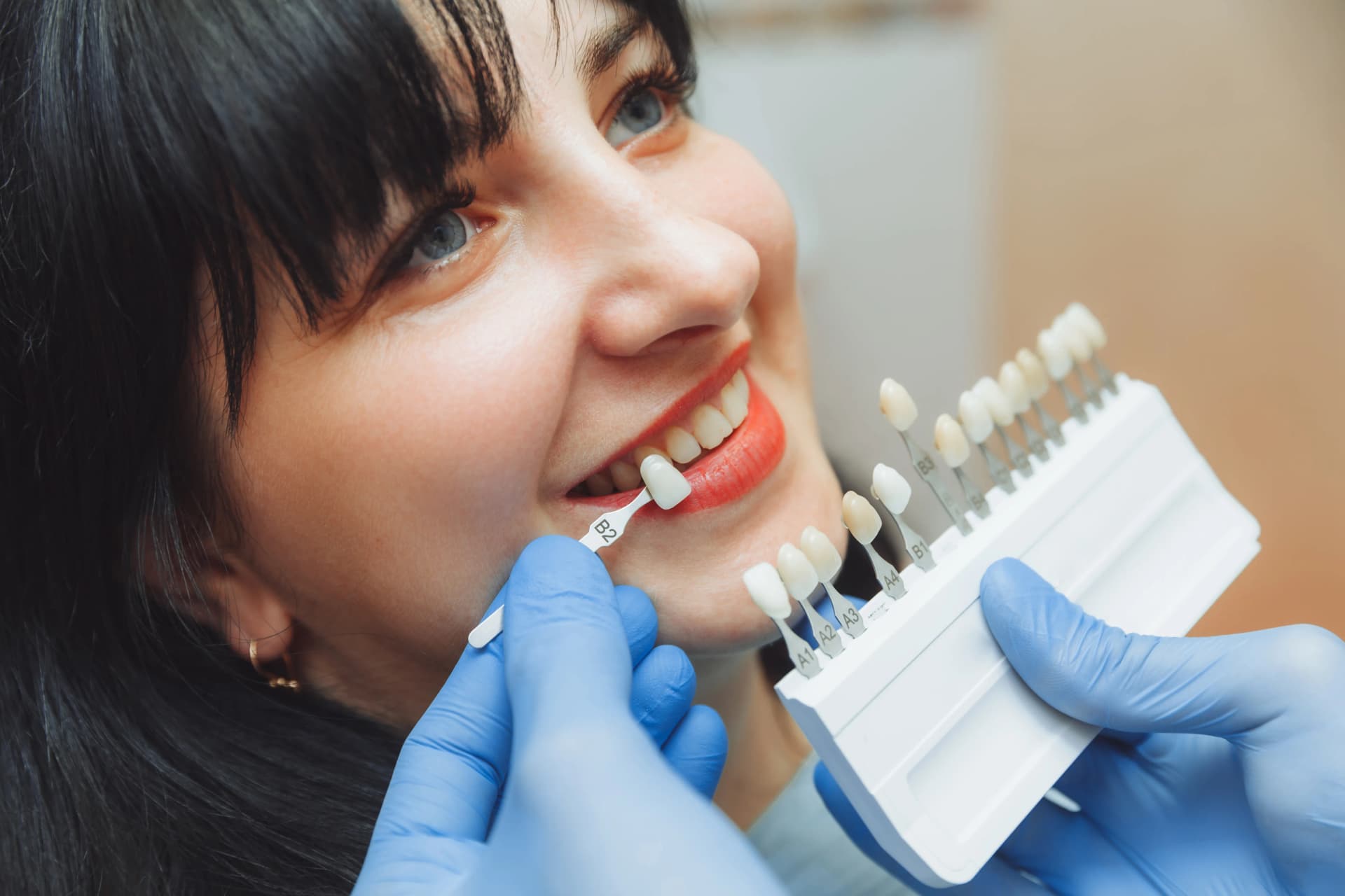 Porcelain veneers in St. Albert